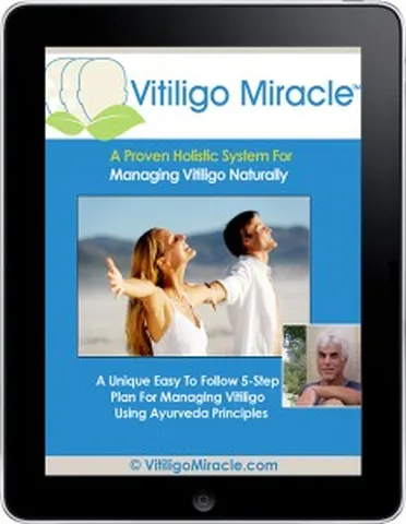 Vitiligo Miracle (eBook) product image